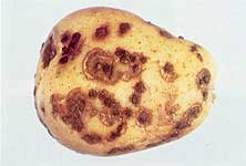 Spongospora subterranea (patates uyuzu)